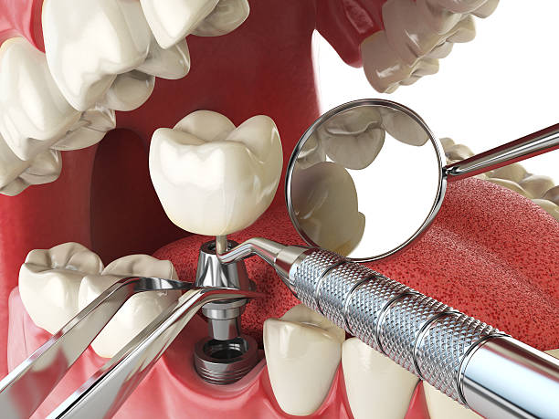Best Emergency Dental Care for Broken or Chipped Teeth in Lake In The Hls, IL